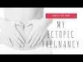 MY ECTOPIC PREGNANCY STORY | LUCIE AND THE BUMP