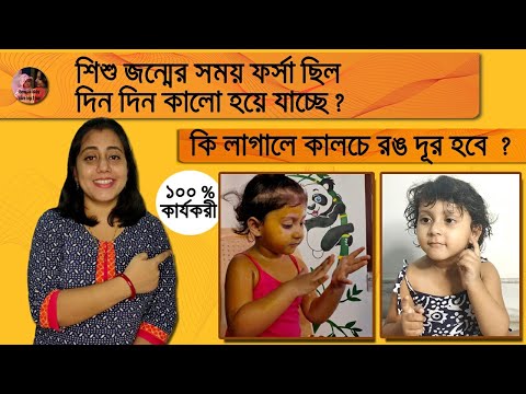 ভিডিও: তুলার শার্ট ছোট করার 3 উপায়