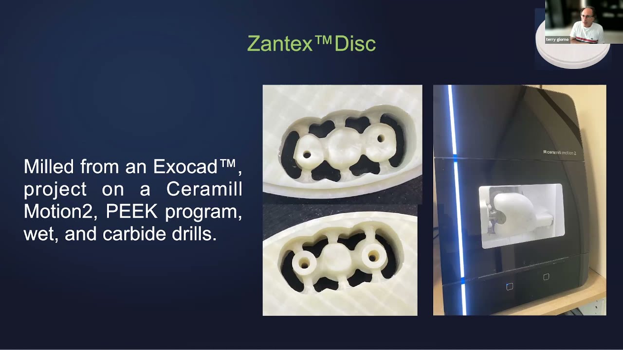 Zantex metal-free frame work for bridges and full mouth reconstructions.
