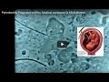 Periodontitis Pregnancy biofilm. Medical nonsense! Dr Mark Bonner
