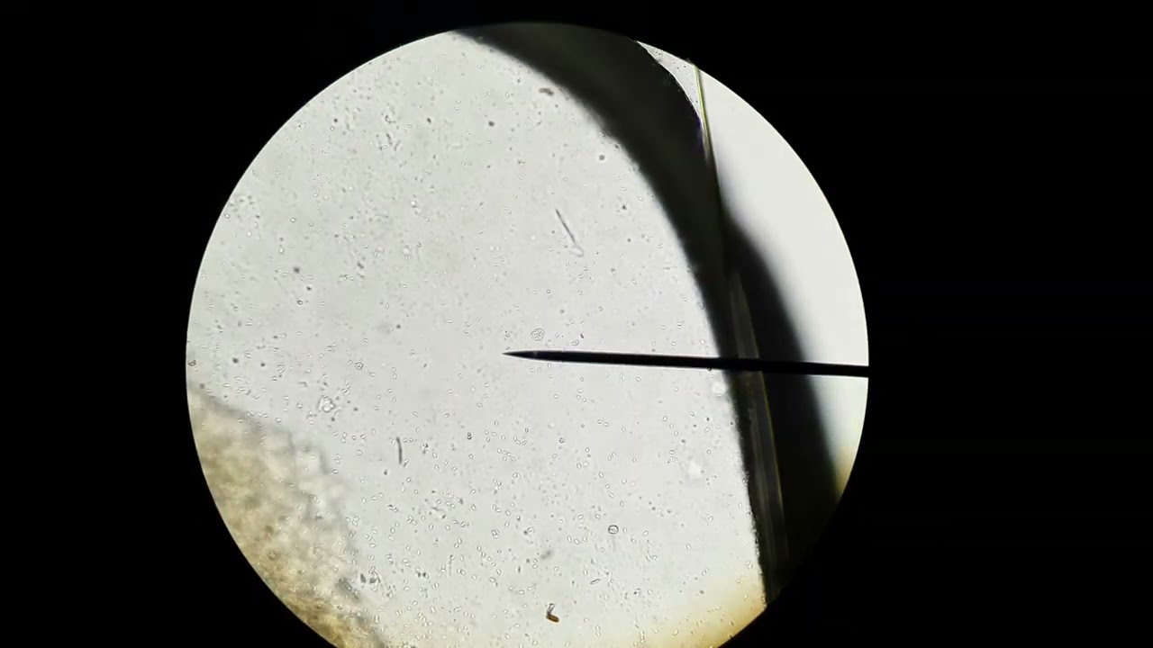 Costia at 40x, 100x, and 400x magnification