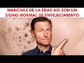 Las manchas de la edad NO son un signo normal de envejecimiento