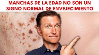 Las manchas de la edad NO son un signo normal de envejecimiento
