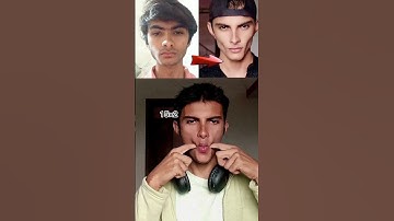 Hollow cheeks exercise #looksmaxxing #faceexercise