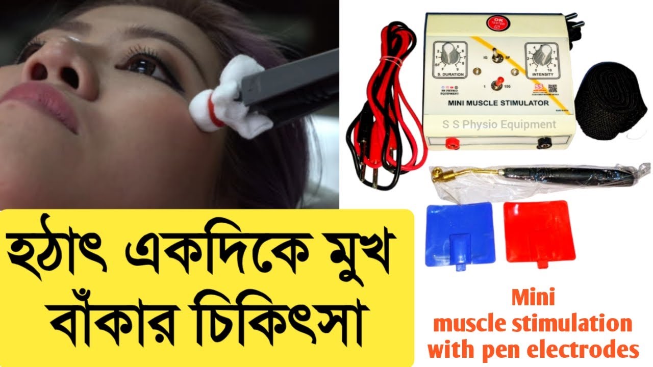 বেলস্ পালসির চিকিৎসা Electrical muscle stimulation for bell's palsy