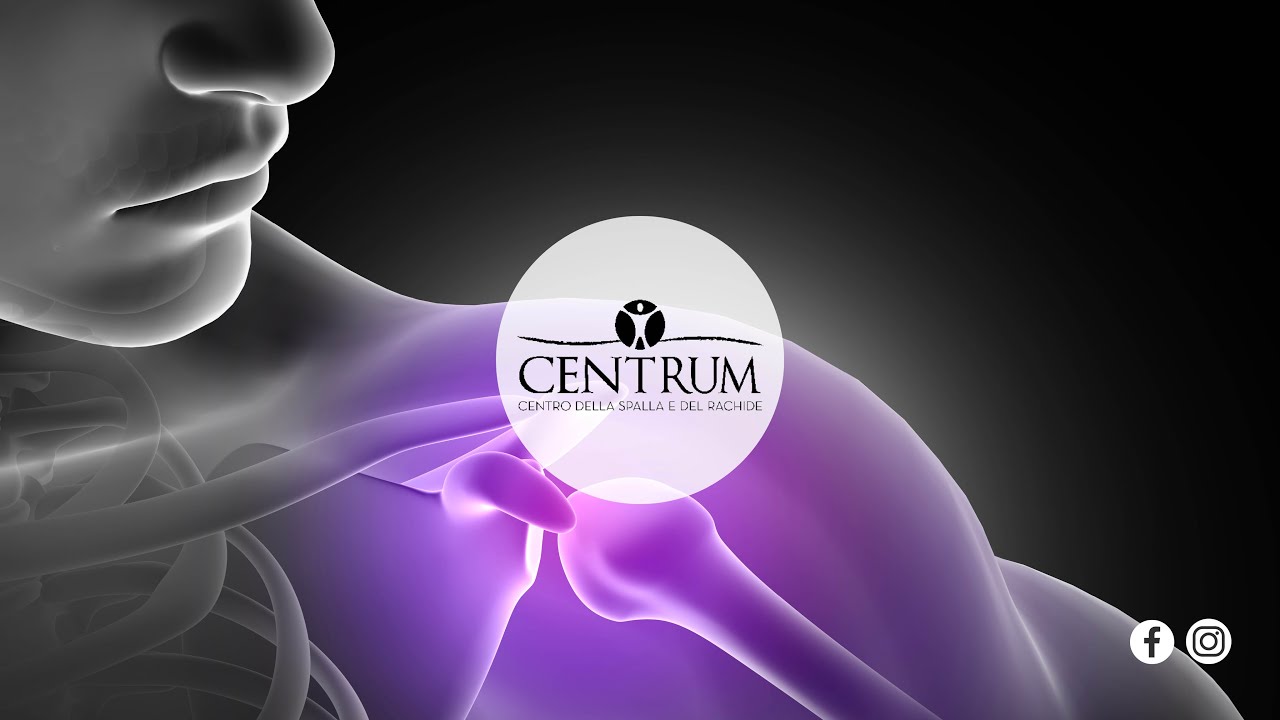 CHIRURGIA DI CUFFIA DEI ROTATORI