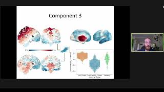 OHBM 2020 | Oral Sessions | Modeling and Analysis - Multivariate multi-modal analysis