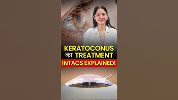 Keratoconus Correction With INTACS | Safe & Effective Treatment