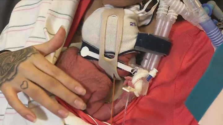 Madera mom survives rare condition and procedure, ...