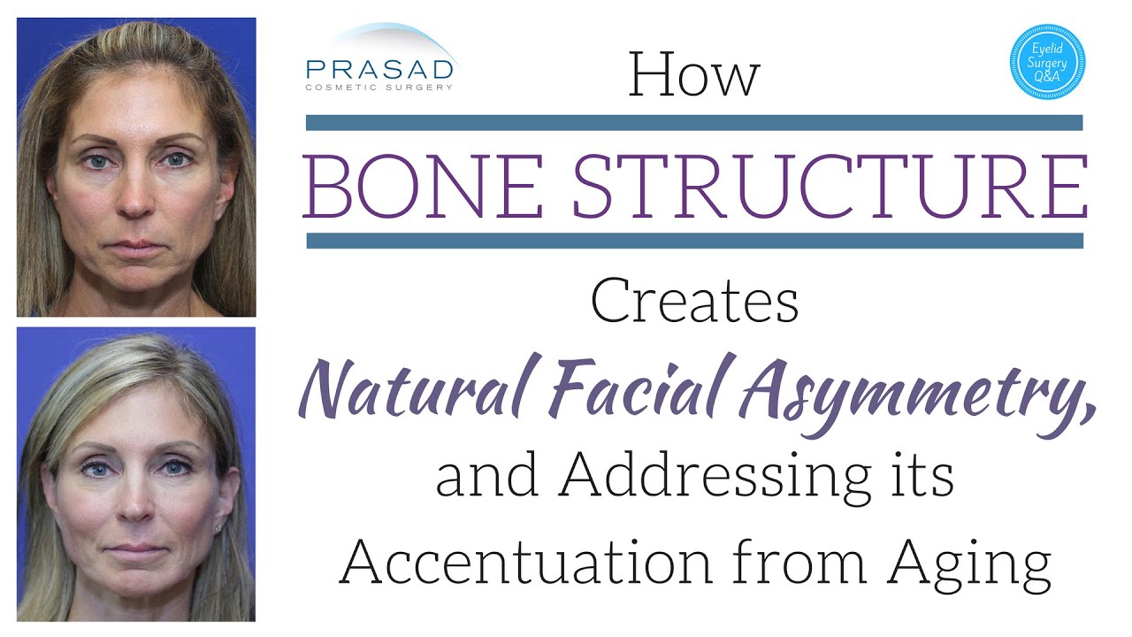 How Facial Asymmetry is Determined by Bone Structure, and Correcting