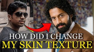 🚨How did I transform my skin❓️! 20 lifestyle habits I followed!