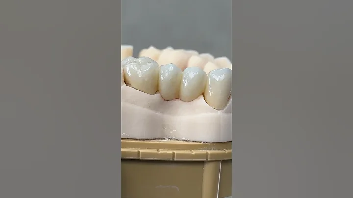 Zen Enamel Bridge @EnvisiontecMain #envisiontec #teeth #dental #smile #lsk121shorts #shorts