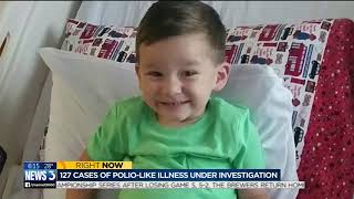 Dr. Mehra talks about 2 cases in Wisconsin of rare disease that can cause paralysis