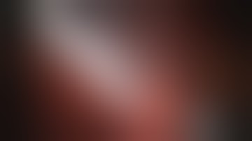 Super selective arterial clamping for robotic partial nephrectomy