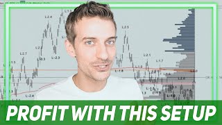 Volume Profile Setup: This will make you tons of money!
