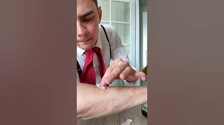 How to remove an adhesive plaster from your arm without pain?😎 #lifehacks