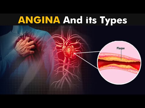 What is Angina And How it Works? | Types, Causes, Symptoms and treatment (3D Animation)