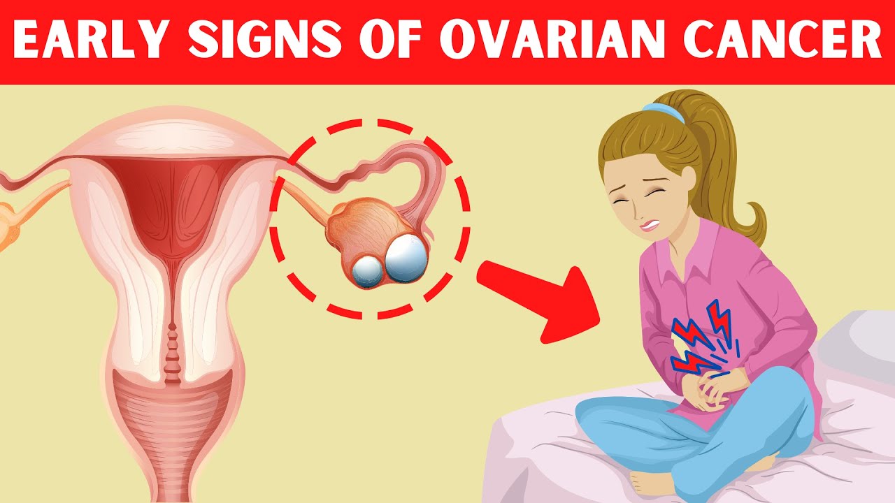 7 Early Warning Signs Of Ovarian Cancer That Every Women Must Know ...