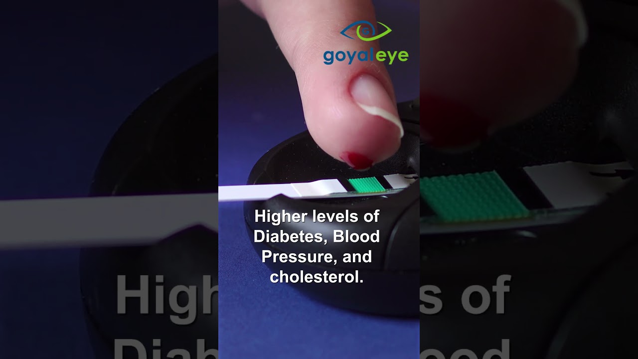 Lifestyle that might trigger Age Related Macular Degeneration