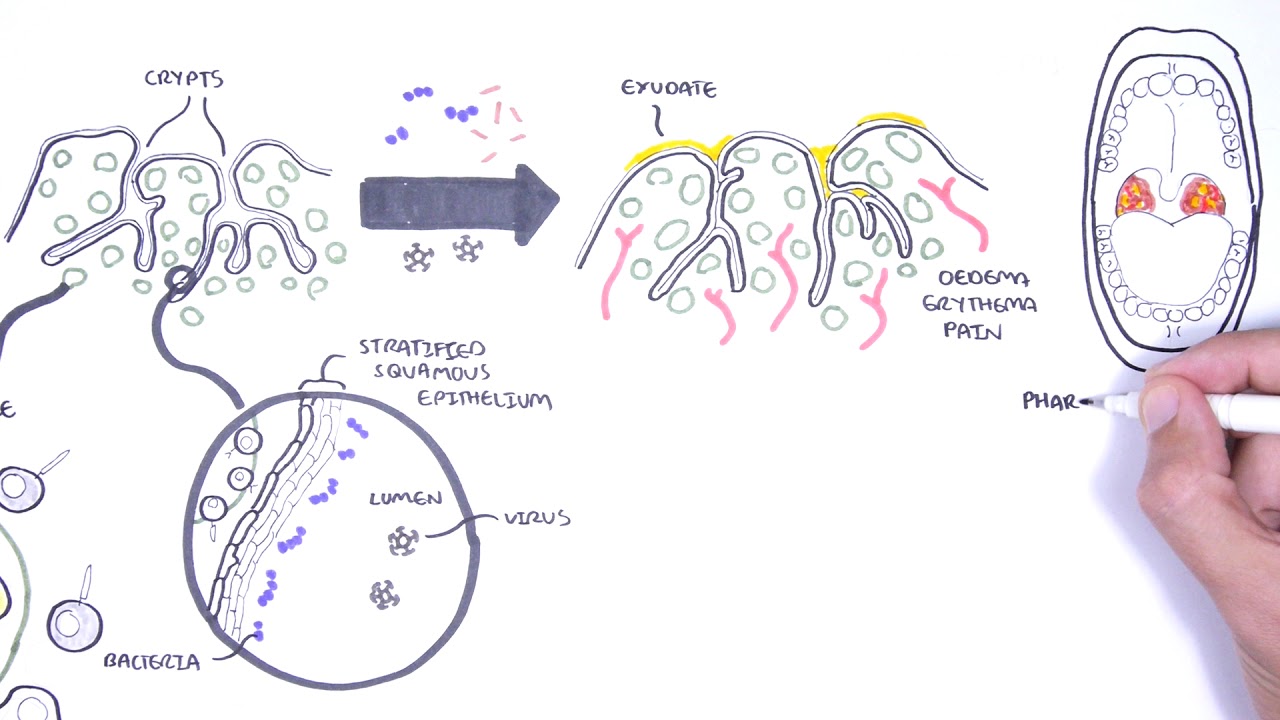 Lymphatic system - Knowledge @ AMBOSS