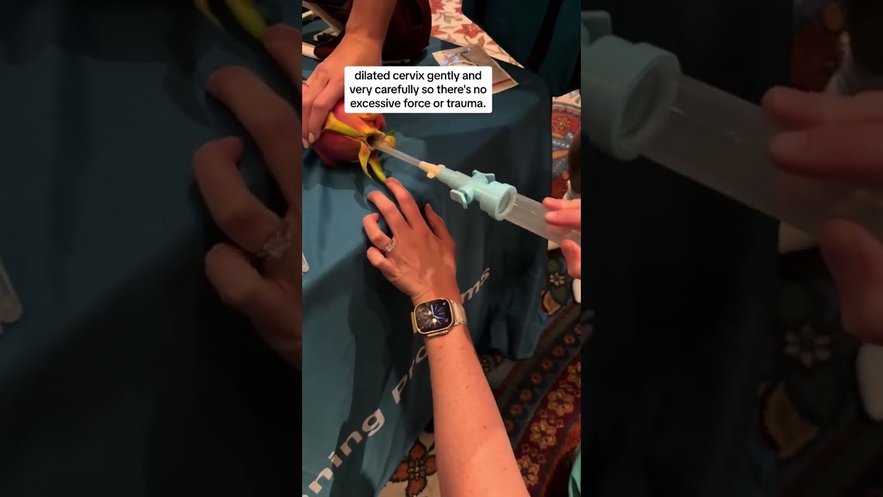 #OBGYN shows first trimester abortion simulation #shorts #medicalstudent