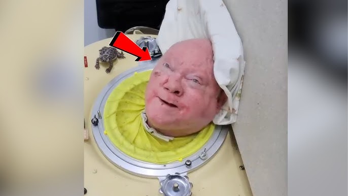 Paul Alexander Dies Man In The Iron Lung Emotional Video Will Make You Cry