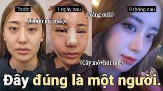 Trở thành hotgirl sau combo mắt-mũi-line mặt tại DM l #nangmui #pttm #review #beforeafter #nhanmi
