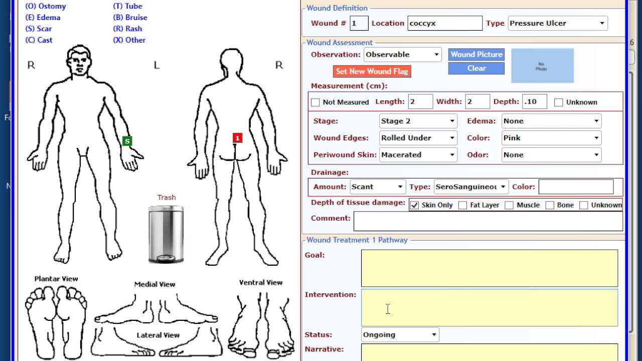 Start Of Care Note  Part 2- Body Diagram