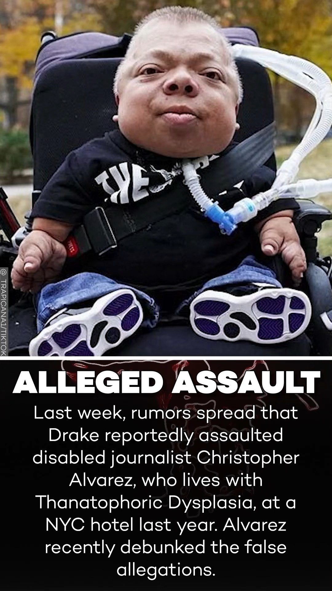 Disabled Journalist Denies Being Assaulted by Drake and Being The OVO Snitch!