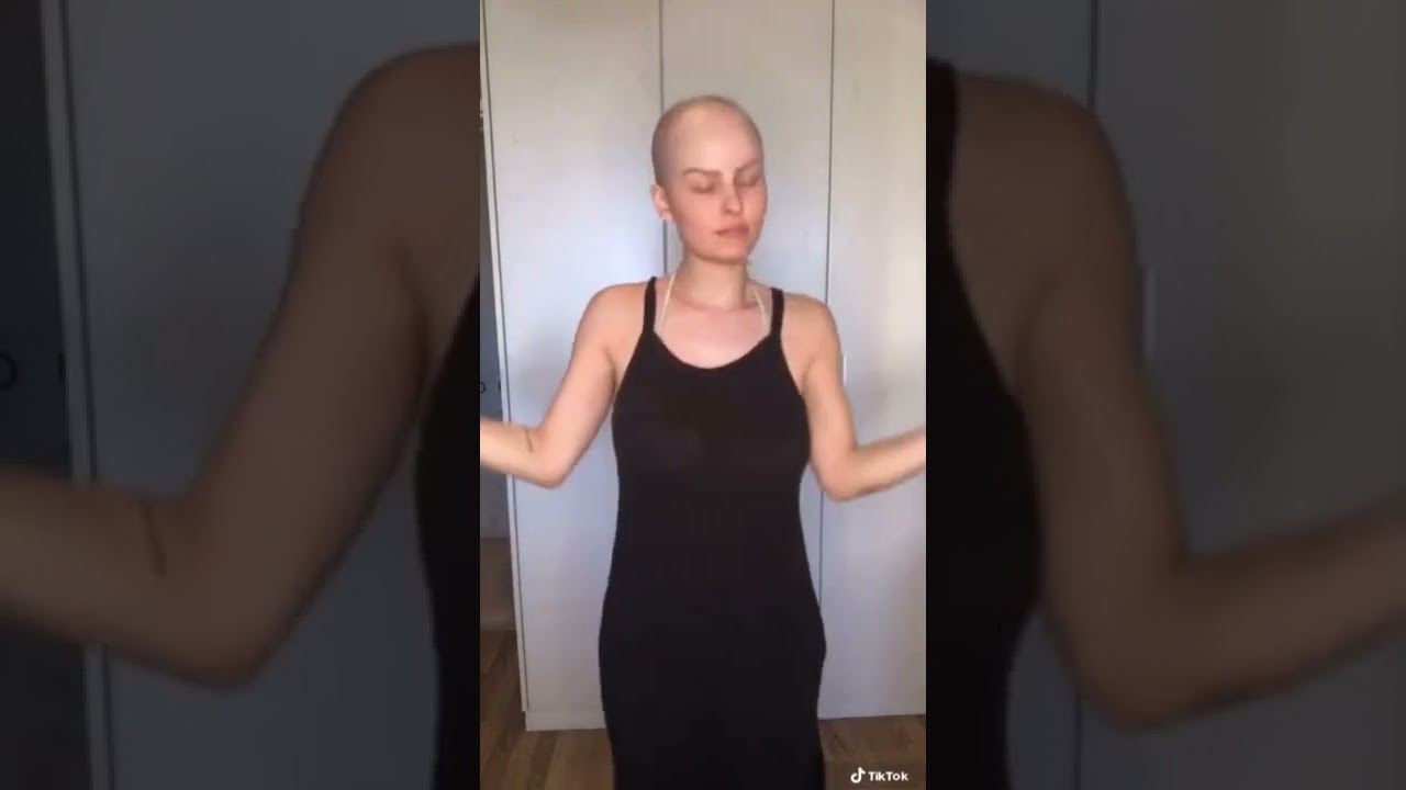 These wigs will transform your look instantly from medical hair loss