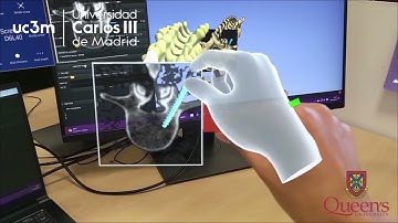 Real time integration between Microsoft HoloLens 2 and 3D Slicer
