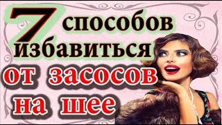 7 способов избавиться от засосов на шее