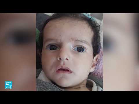 غزة: أزمة حليب الأطفال وسوء التغذية يهددان حياة الرضع