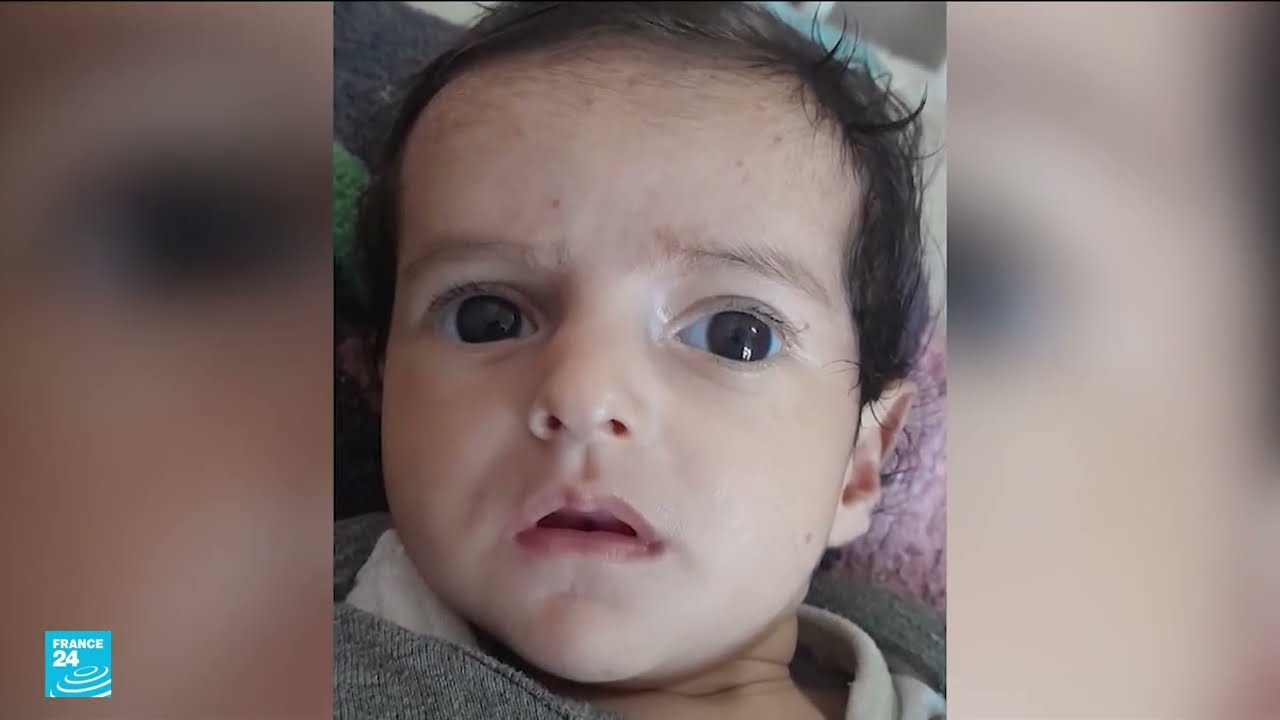 منظمة الصحة العالمية: وفاة 57 طفلا في قطاع غزة بسبب الجوع