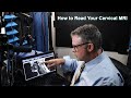 How to Read Your Cervical MRI (Part I of 2): A Deep Dive Into How to Read Your Cervical MRI.