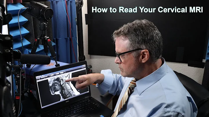 How to Read Your Cervical MRI (Part I of 2): A Dee...