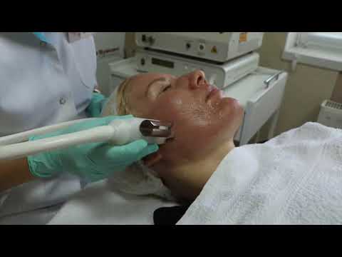 Video: Îndepărtarea Cicatricilor: Metode Eficiente și Beneficiile Acestora