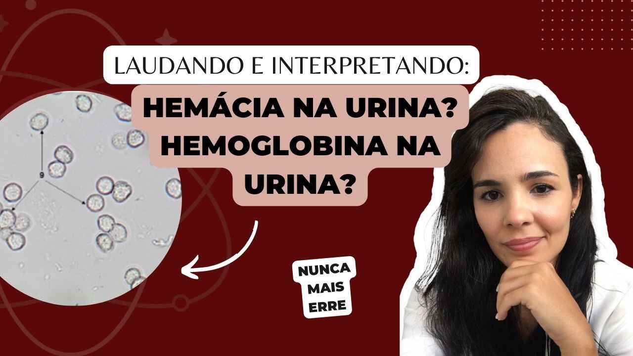 Hemoglobina Na Urina Presente - FDPLEARN