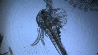 Brine Shrimp Under Microscope