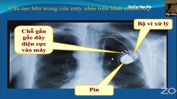 BÀI 8 ĐIỆN TÂM ĐỒ MÁY TẠO NHỊP