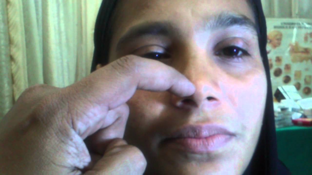 Examination of the Nose. 