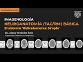 Neuroanatomía seccional básica (TAC y RM) - El sistema "ridículamente simple"