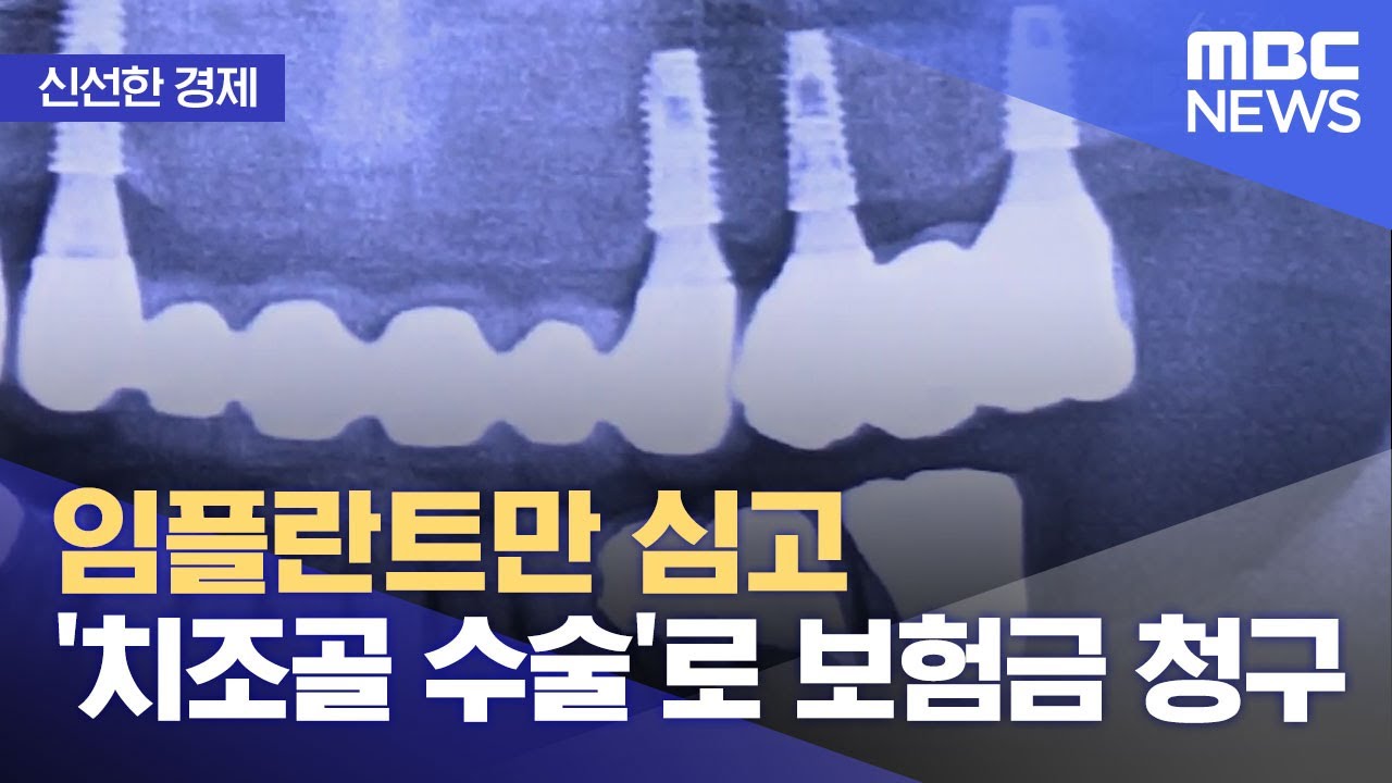 [신선한 경제] 임플란트만 심고 '치조골 수술'로 보험금 청구 (2021.12.20/뉴스투데이/MBC)