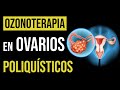 ✅ VENTAJAS de la Ozonoterapia para el Síndrome del Ovario Poliquístico
