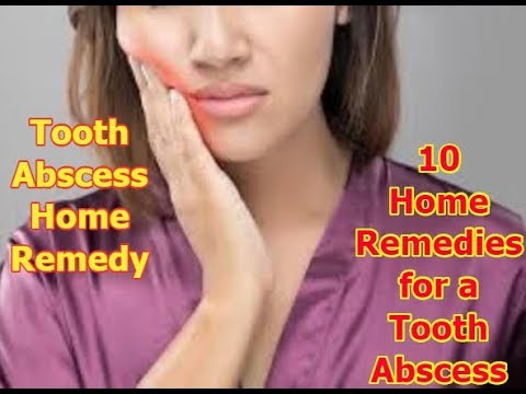 Video: Home Remedies Voor Abces Tooth: 10 Remedies Voor Zwelling En Pijn