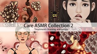 ASMR Treatment Animated Series 2｜trypophobia,pustule treatment,Blackhead removal｜big collection