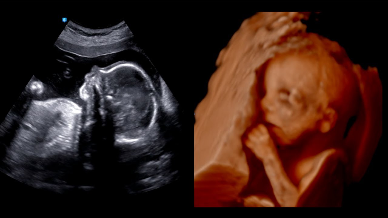 Baby at 21 weeks pregnant | 21 weeks 🤰 - YouTube