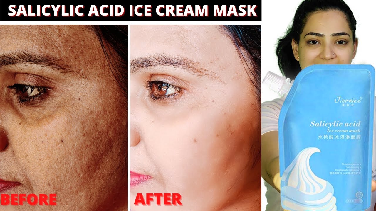 Salicylic acid mask Salicylic acid ice cream mask review Salicylic