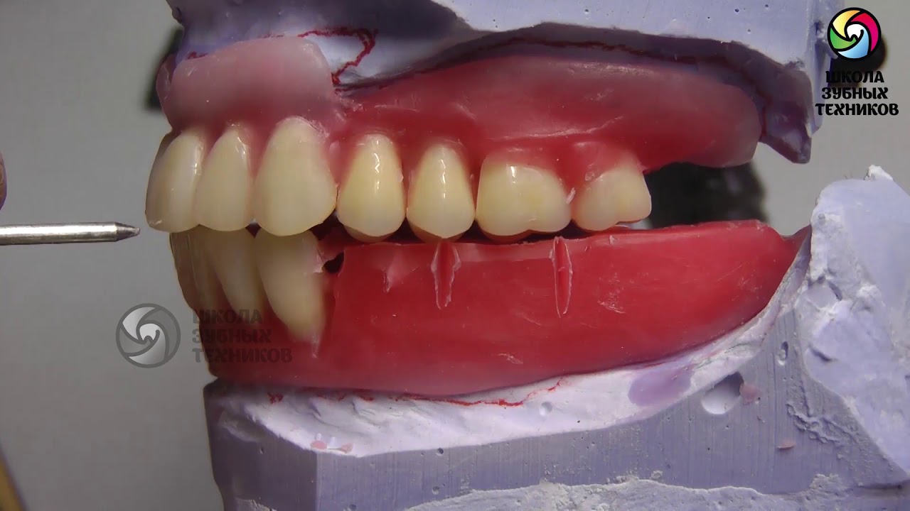 Анатомическая постановка зубов по стеклу, по сферической поверхности.