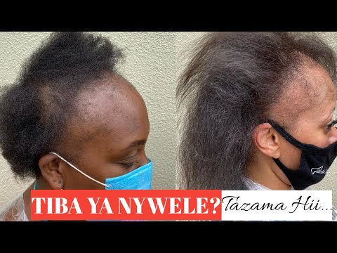 Video: Njia 3 za Kutibu Nywele Zilizoharibika